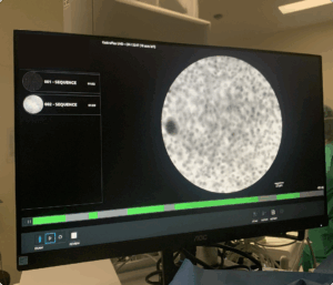 Real-Time Imaging on Static CLE Interface
