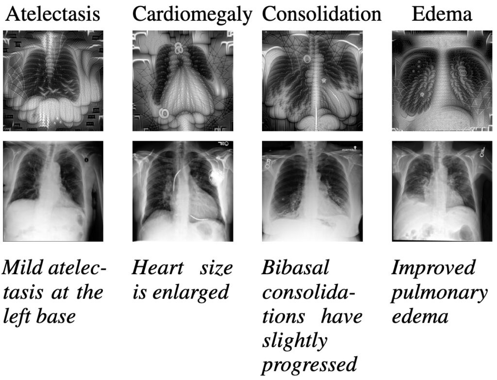 Comparison of actual X-ray scans and synthetic images generated by the model 