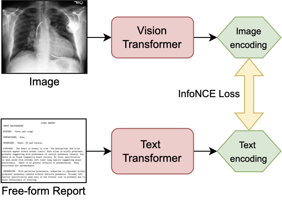 Contrastive language supervision of the vision and text transformer by applying InfoNCE Loss on the image and text encodings
